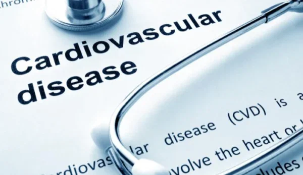 Ibsen-CVD OCT Cardiovascular diagonistics