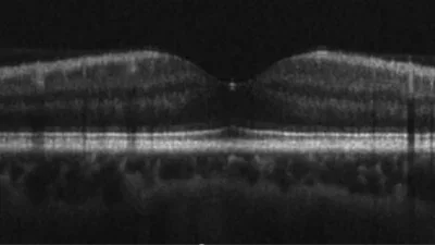 SD-oct-b-scan Image of Spectrometer for Raman Spectroscopy